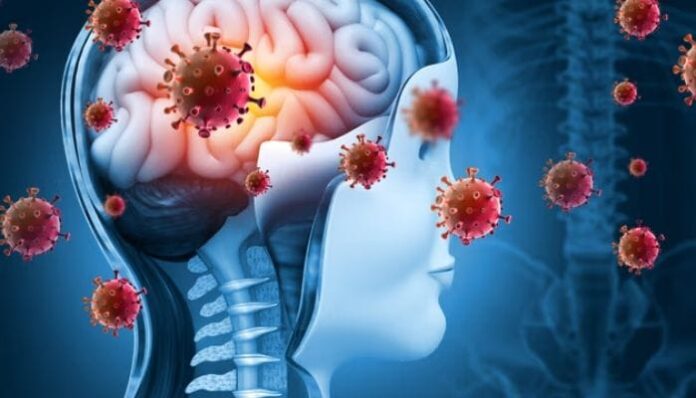 meningitis